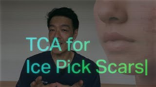 Treatments for Ice pick acne scars  Dr Davin Lim [upl. by Enelrahc829]