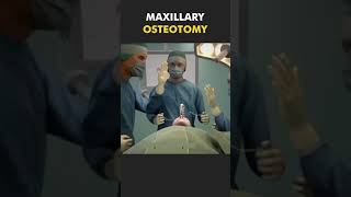 Maxillary Osteotomy Procedure 3D Animation [upl. by Faye]