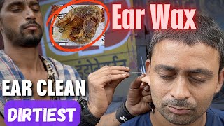 Dirtiest Ear Wax found During Ear Cleaning at Street Side Ear Cleaner  ASMR [upl. by Annodal]