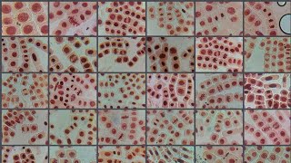 2 ACETICACETO ORCEIN STAINED ONION ROOT TIP CELL DIVISION STAGES [upl. by Grussing342]