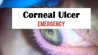 Corneal Ulcer Emergency [upl. by Gussy92]