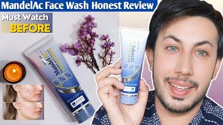 jenphram Mandelic Acid Facewash Review  Mandelic Acid Cleanser [upl. by Bowen]