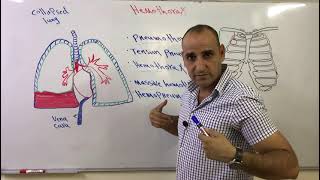 اصابات الصدر المدمى Hemothorax and massive hemothorax [upl. by Roscoe]