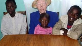 Witch Doctors Killing Albinos To Sell Body Parts [upl. by Ahseila671]