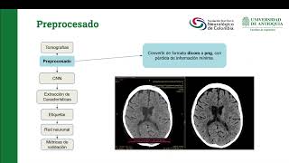 Presentación clasificador de tomografías [upl. by Wang]