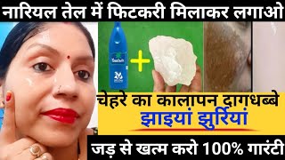 कितनी भी पुरानी झाइयां Pigmentation जड़ से खत्म करो How To Remove Pigmentation [upl. by Elleahcim]