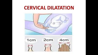 CERVICAL DILATATION [upl. by Spatola581]