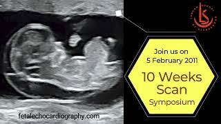 10 Weeks Scan Symposium 2022 [upl. by Winther]