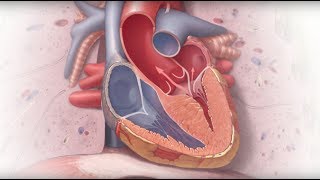 Genetics and Cardiomyopathy  Mayo Clinic [upl. by Atnomed774]