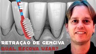 Tenho RETRAÇÃO GENGIVAL  Quais Escovas Dentais Devo Usar Comparação Curaprox Colgate OralB [upl. by Barden468]