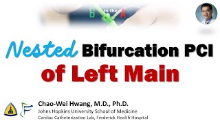 Nested Bifurcation Stenting of Left Main Trifurcation [upl. by Sokram]