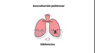 Ruidos respiratorios agregados  Sibilancias [upl. by Snodgrass195]