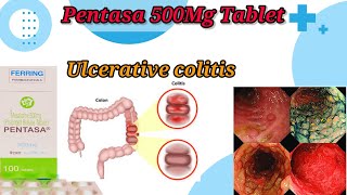 Pentasa 500Mg Tablet UseBenefitsSide EffectsUlcerative Colitis TreatmentFull Reviews [upl. by Ordisi]