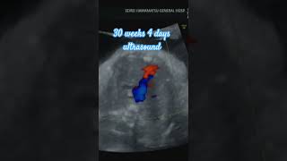 30 weeks 4 days pregnant 11192024 baby cute cutebaby love ymshoppewithshinyu 30weekspregnant [upl. by Navak]