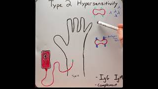 Type 2 hypersensitivity reaction in 2 mins [upl. by Chem15]