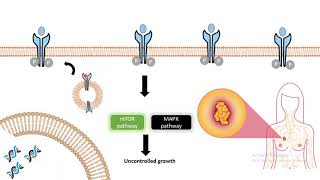 Clinical usage of antibody Herceptin Antibody as breast cancer medicine [upl. by Amesari]