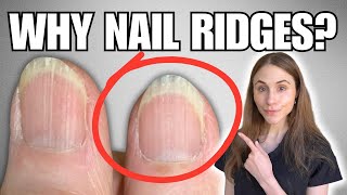 Why You Have Vertical Nail Ridges And How To Get Rid Of Them [upl. by Ethyl273]