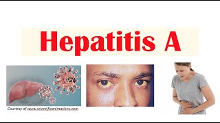 Hepatitis A  Virus Risk Factors Pathophysiology Signs amp Symptoms Diagnosis Treatment [upl. by Ogirdor]