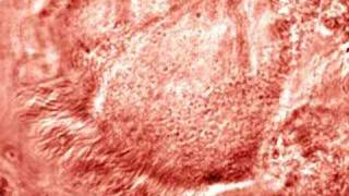 Metachronal Wave in Mucociliary Transport [upl. by Ruben]