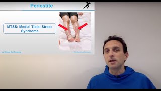 Periostite o Medial Tibial Stress Syndrome cosa e cosa si fa [upl. by Nilyaj879]