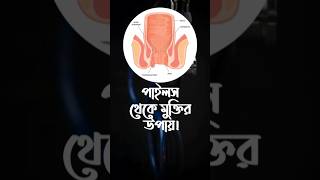 পাইলস থেকে মুক্তি  Nitricum Acidum  piles পাইলস [upl. by Kit513]