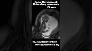 Foetal DevelopmentBaby Movement at 24 week shorts foetus viralshort [upl. by Katharina]