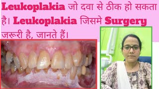 White Patch in mouthLeukoplakia amp its typesWhich Leukoplakia is dangerous amp transform to Cancer [upl. by Rhtaeh]