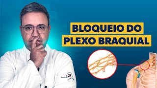 Bloqueio do Plexo Braquial [upl. by Erised]