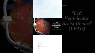 Left Ventricular Assist Device LVAD [upl. by Ul737]