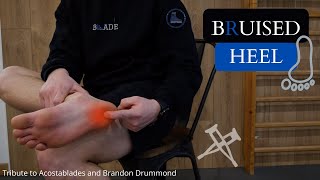 Bruised Heel Treatment [upl. by Nirrol809]