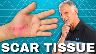 How to Get Rid of Scar Tissue After Surgery or Injury Hardened [upl. by Evad]