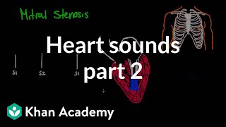 Systolic murmurs diastolic murmurs and extra heart sounds  Part 2  NCLEXRN  Khan Academy [upl. by Marcille]