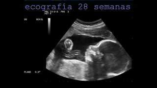 ecografia 4D 28 semanas [upl. by Thelma]