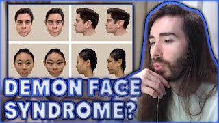 What Is Demon Face Syndrome  MoistCr1tikal [upl. by Regnij]