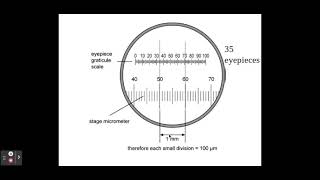 Liraglutide  Uses Dosage Side Effects amp Mechanism  Victoza [upl. by Aciamaj]