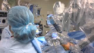 daVinci® SingleSite® Gallbladder Surgery  Middlesex Hospital [upl. by Gnurt]