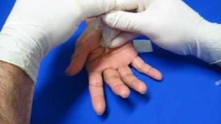 Hand Injection Techniques  Trigger Finger [upl. by Vincents]