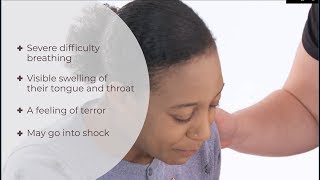 What is anaphylaxis  Anaphylactic shock  First Aid  iHASCO [upl. by Canty]