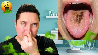 10 Reasons You Have Bad Breath [upl. by Aninad]