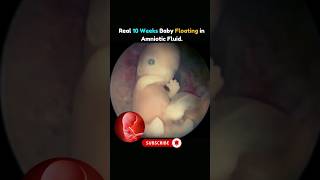 10 Weeks Baby Real Video in the Womb pregnancy fetus videoshorts [upl. by Alimaj117]