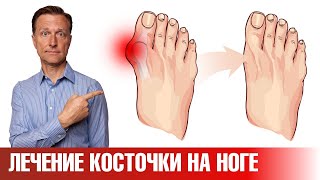 Эти 5 упражнений помогут убрать косточку на большом пальце ноги✅ [upl. by Einneg]