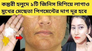 রাতে এটামাখো ১দিনে ত্বক ফর্সা উজ্জ্বল দাগহীন হবেমুখের কালো দাগ দূর করার উপায়mesta dur korar upay [upl. by Laurance]