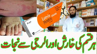 Lotrix Cream is used for the treatment controlfollowing diseases Itchiness Scabies by Dr Nawaz [upl. by Chery908]