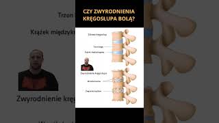 Zwyrodnienie a ból kręgosłupa pain spine physiotherapy [upl. by Courtland765]