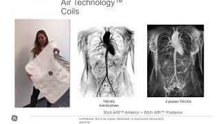 MRI coil technology past present and future Fraser Robb PhD [upl. by Zoller]