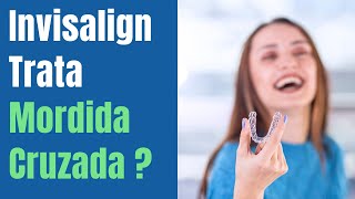 O Invisalign trata a Mordida Cruzada  aparelhortodontico invisalign [upl. by Pavier]