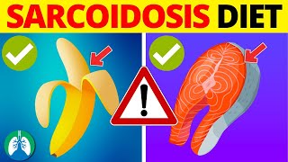 Sarcoidosis Diet  ONLY Eat These Foods and Which Ones to AVOID [upl. by Michaeline]