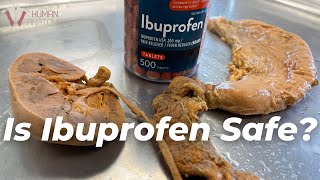 What Ibuprofen Does to the Body [upl. by Yvonne]