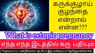 What is ectopic pregnancy in tamil full explanation for ectopic pregnancyNilas pregnancy tips [upl. by Lethia]