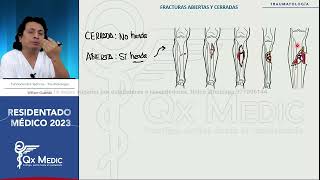 Fracturas Generalidades Traumatología [upl. by Akyeluz]